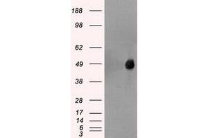 Image no. 1 for anti-Forkhead Box A1 (FOXA1) antibody (ABIN1498292) (FOXA1 antibody)