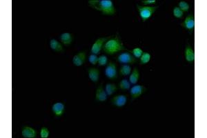 Immunofluorescence staining of Hela cells with ABIN7154719 at 1:166, counter-stained with DAPI. (GNAT3 antibody  (AA 2-354))