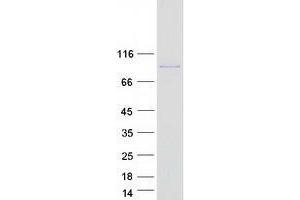 Validation with Western Blot (ZFP91 Protein (Myc-DYKDDDDK Tag))