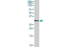 FLJ11151 MaxPab polyclonal antibody. (FLJ11151 (AA 1-314) antibody)
