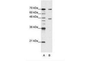 Image no. 2 for anti-Poly(A) Binding Protein, Cytoplasmic 4 (Inducible Form) (PABPC4) (AA 181-230) antibody (ABIN202848) (PABPC4 antibody  (AA 181-230))