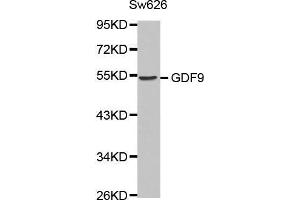 Western blot analysis of extracts of Sw626 cell line, using GDF9 antibody. (GDF9 antibody  (AA 205-454))