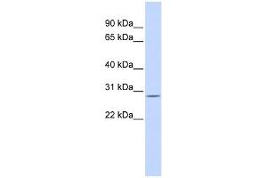 ECHS1 antibody used at 1 ug/ml to detect target protein. (ECHS1 antibody  (N-Term))