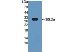 Detection of Recombinant CRISP1, Rat using Polyclonal Antibody to Cysteine Rich Secretory Protein 1 (CRISP1) (CRISP1 antibody  (AA 20-246))