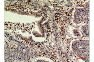 Immunohistochemistry (IHC) analysis of paraffin-embedded Human Liver, antibody was diluted at 1:100. (Thrombopoietin antibody  (Internal Region))