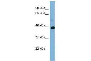 GAPDH antibody used at 1 ug/ml to detect target protein. (GAPDH antibody  (Middle Region))