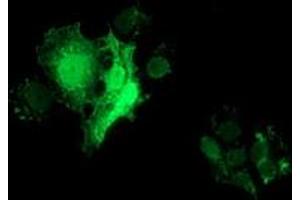 Anti-FHL1 mouse monoclonal antibody (ABIN2453042) immunofluorescent staining of COS7 cells transiently transfected by pCMV6-ENTRY FHL1 (RC203478). (FHL1 antibody)