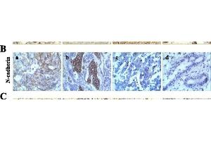 Immunohistochemistry (IHC) image for anti-Cadherin 2 (CDH2) (AA 701-800) antibody (ABIN738726)