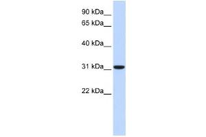 Western Blotting (WB) image for anti-Carbonic Anhydrase VIII (CA8) antibody (ABIN2458629) (CA8 antibody)