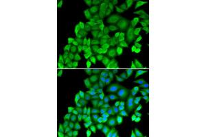 Immunofluorescence (IF) image for anti-Proteasome (Prosome, Macropain) Subunit, beta Type, 4 (PSMB4) antibody (ABIN1876898) (PSMB4 antibody)