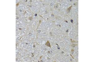 Immunohistochemistry of paraffin-embedded mouse brain using CHN1 antibody (ABIN5974737) at dilution of 1/100 (40x lens). (CHN1 antibody)