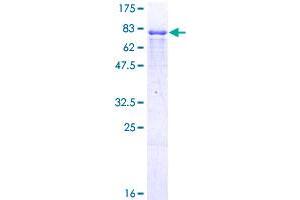 ING3 Protein (AA 1-418) (GST tag)