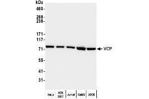 Western Blotting (WB) image for anti-Valosin Containing Protein (VCP) (C-Term) antibody (ABIN7452151) (VCP antibody  (C-Term))
