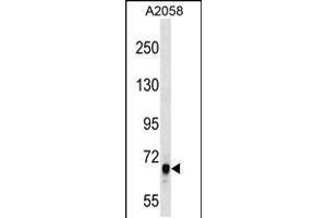 Western blot analysis in A2058 cell line lysates (35ug/lane). (ARHGEF5 antibody  (C-Term))