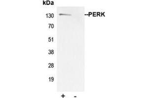 Immunoprecipitation (IP) image for anti-Eukaryotic Translation Initiation Factor 2-alpha Kinase 3 (EIF2AK3) (N-Term) antibody (ABIN7297604)
