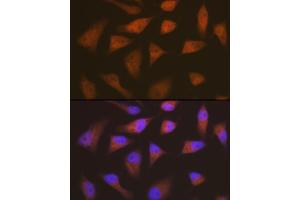 Immunofluorescence analysis of HeLa cells using CDKN2C/p18-INK4C Rabbit mAb  at dilution of 1:100 (40x lens). (CDKN2C antibody)