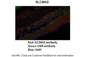 Primary Antibody Dilution :  1:200  Secondary Antibody :   Goat anti-rabbit Alexafluor 568  Secondary Antibody Dilution :  1:200  Color/Signal Descriptions :  SLC38A3: Red CtBp: Green DAPI: Blue  Gene Name :  SLC38A3  Submitted by :  Anonymous