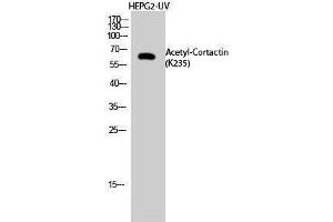 Western Blotting (WB) image for anti-Cortactin (CTTN) (acLys235) antibody (ABIN3188005) (Cortactin antibody  (acLys235))