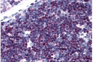 Human Thymus (formalin-fixed, paraffin-embedded) stained with SATB1 antibody ABIN343896 at 5 ug/ml followed by biotinylated goat anti-rabbit IgG secondary antibody ABIN481713, alkaline phosphatase-streptavidin and chromogen. (SATB1 antibody  (C-Term))