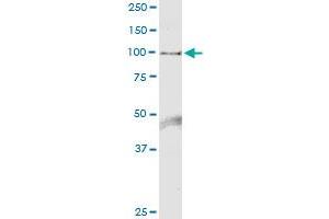 Immunoprecipitation of HELLS transfected lysate using anti-HELLS MaxPab rabbit polyclonal antibody and Protein A Magnetic Bead , and immunoblotted with HELLS purified MaxPab mouse polyclonal antibody (B01P) . (HELLS antibody  (AA 1-838))
