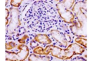 IHC image of ABIN7157866 diluted at 1:100 and staining in paraffin-embedded human kidney tissue performed on a Leica BondTM system. (LAMA3 antibody  (AA 1570-1796))