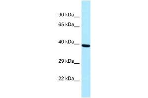 Western Blotting (WB) image for anti-PRP18 Pre-mRNA Processing Factor 18 (PRPF18) (Middle Region) antibody (ABIN2774355) (PRPF18 antibody  (Middle Region))