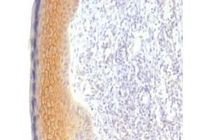 Formalin-fixed, paraffin-embedded human Skin stained with Catenin, gamma Monoclonal Antibody (CTNG/1483)