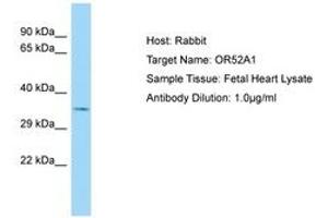 Image no. 1 for anti-Olfactory Receptor, Family 52, Subfamily A, Member 1 (OR52A1) (AA 222-271) antibody (ABIN6750123) (OR52A1 antibody  (AA 222-271))