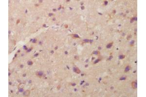 Formalin-fixed and paraffin embedded rat brain labeled with Anti-ITM2A Polyclonal Antibody, Unconjugated  at 1:200 followed by conjugation to the secondary antibody and DAB staining