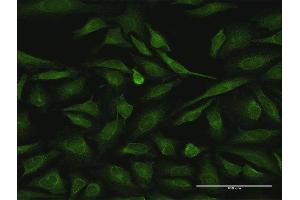 Immunofluorescence of purified MaxPab antibody to RIPK2 on HeLa cell. (RIPK2 antibody  (AA 1-540))