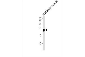 Western blot analysis of lysate from human skeletal muscle tissue lysate,using SCN4B Antibody. (SCN4B antibody)