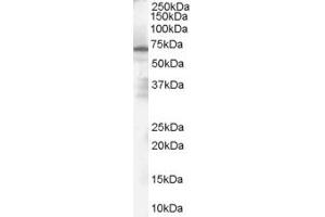 PARP2 antibody  (Internal Region)