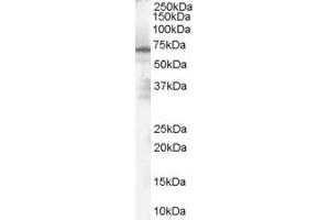 ABIN185561 (1µg/ml) staining of Human Spleen Lysate (35µg protein in RIPA buffer).