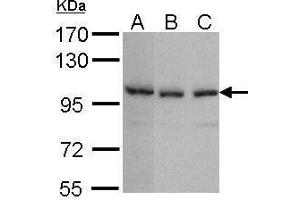 WB Image Sample (30 ug of whole cell lysate) A: A431 , B: Hela C: Hep G2 , 7. (TNKS2 antibody  (N-Term))