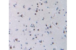 IHC-P analysis of brain tissue, with DAB staining.