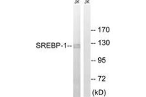 Western blot analysis of extracts from Jurkat cells, treated with TNF 20ng/ml 30', using SREBP-1 (Ab-439) Antibody. (SREBF1 antibody  (AA 405-454))