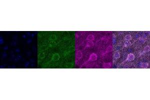 Immunohistochemistry (IHC) image for anti-Calcium/calmodulin-Dependent Protein Kinase II alpha (CAMK2A) antibody (ABIN7456112) (CAMK2A antibody)