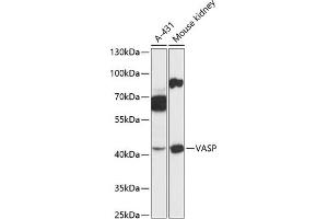 Western blot analysis of extracts of various cell lines, using VASP antibody (ABIN6134453, ABIN6150064, ABIN6150065 and ABIN6218508) at 1:3000 dilution. (VASP antibody  (AA 1-100))