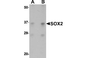 Western Blotting (WB) image for anti-SRY (Sex Determining Region Y)-Box 2 (SOX2) (N-Term) antibody (ABIN1031582) (SOX2 antibody  (N-Term))