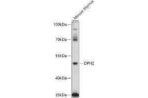 Western blot analysis of extracts of Mouse thymus, using DPH2 antibody (ABIN7266787) at 1:1000 dilution. (DPH2 antibody  (AA 120-330))
