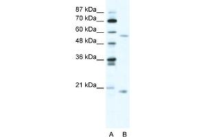 WB Suggested Anti-ZNF18 Antibody Titration:  5ug/ml  Positive Control:  HepG2 cell lysate