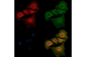 ABIN6261249 and ABIN6268912 staining  cells by IF/ICC.