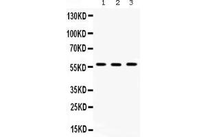 Western blot analysis of TCP1 beta expression in rat testis extract ( Lane 1), mouse spleen extract ( Lane 2) and SW620 whole cell lysates ( Lane 3).