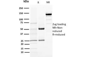 SDS-PAGE Analysis Purified DOG-1 Mouse Monoclonal Antibody (DG1/1484). (ANO1 antibody  (AA 2-101))