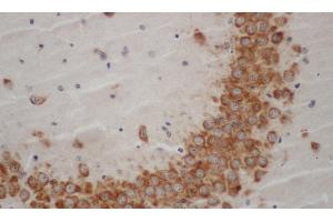 Immunohistochemistry of paraffin-embedded Mouse brain using WNT1 Polyclonal Antibody at dilution of 1:50 (WNT1 antibody)
