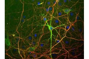 Embryonic rat cortical cells grown in tissue culture and stained with ABIN1580447 (green) and the phosphorylated axonal form of neurofilament NF-H, using CPCA-NF-H antibody (red). (NEFL antibody)