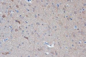 Immunohistochemistry of paraffin-embedded rat brain using Raptor Rabbit mAb (ABIN7269900) at dilution of 1:100 (40x lens). (Raptor antibody)