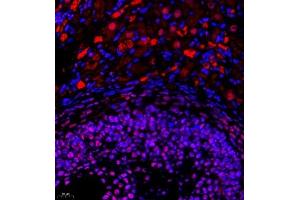 Immunofluorescence of paraffin embedded rat ovary using Skar (ABIN7074970) at dilution of 1:950 (400x lens) (p46 antibody)