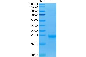 Biotinylated Human IL-5 on Tris-Bis PAGE under reduced condition. (IL-5 Protein (AA 20-134) (His-Avi Tag,Biotin))