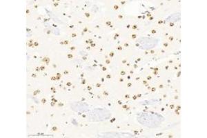 Immunohistochemistry analysis of paraffin-embedded mouse brain using,SETD2 (ABIN7075582) at dilution of 1: 3600 (SETD2 antibody)